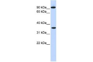 EXT2 antibody used at 1 ug/ml to detect target protein. (EXT2 抗体)