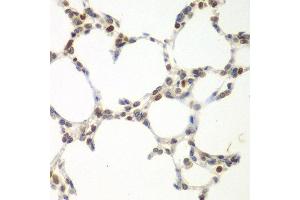 Immunohistochemistry of paraffin-embedded mouse lung using VRK1 antibody at dilution of 1:100 (40x lens). (VRK1 抗体)
