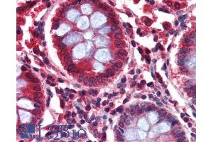 Immunohistochemistry (IHC) image for anti-Glutamate Decarboxylase 2 (Pancreatic Islets and Brain, 65kDa) (GAD2) (Internal Region) antibody (ABIN185388)