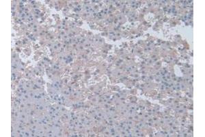 IHC-P analysis of Rat Adrenal Gland Tissue, with DAB staining. (Interferon gamma 抗体  (AA 23-156))