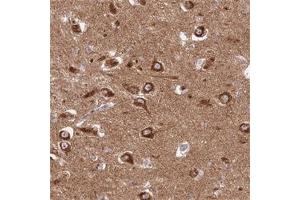 Immunohistochemical staining of human hippocampus with GOLGA3 polyclonal antibody  shows strong cytoplasmic positivity in neuronal cells at 1:500-1:1000 dilution. (Golgin A3 抗体)