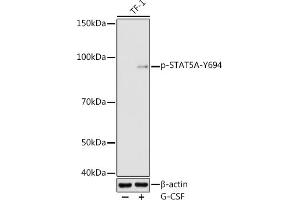 Western blot analysis of extracts of TF-1 cells, using Phospho-STA-Y694 antibody (ABIN3019613, ABIN3019614, ABIN3019615 and ABIN6225491) at 1:1000 dilution. (STAT5A 抗体  (pTyr694))