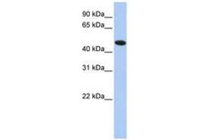 Image no. 1 for anti-Thioredoxin Domain Containing 5 (Endoplasmic Reticulum) (TXNDC5) (AA 36-85) antibody (ABIN6741464) (TXNDC5 抗体  (AA 36-85))