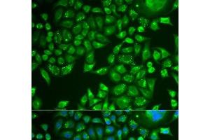 Immunofluorescence analysis of U2OS cells using PNLIP Polyclonal Antibody (PNLIP 抗体)