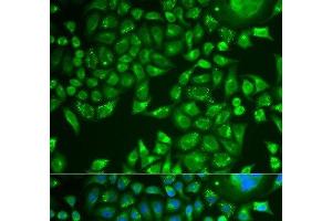 Immunofluorescence analysis of U2OS cells using PNLIP Polyclonal Antibody (PNLIP 抗体)