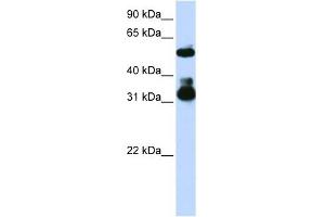 FBXW2 antibody used at 1 ug/ml to detect target protein. (FBXW2 抗体  (Middle Region))