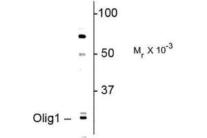 Image no. 1 for anti-Oligodendrocyte Transcription Factor 1 (OLIG1) antibody (ABIN372692) (OLIG1 抗体)