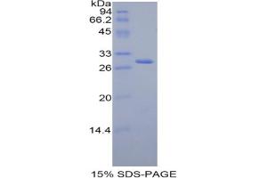 SDS-PAGE analysis of Rat FDFT1 Protein. (FDFT1 蛋白)