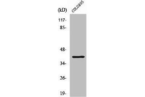 Western Blot analysis of COLO205 cells using ABHD6 Polyclonal Antibody (ABHD6 抗体  (Internal Region))