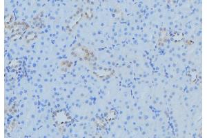 ABIN6279543 at 1/100 staining Mouse kidney tissue by IHC-P.