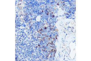 Immunohistochemistry of paraffin-embedded mouse spleen using IFNGR1 Rabbit pAb (ABIN6127566, ABIN6142197, ABIN6142198 and ABIN6221420) at dilution of 1:100 (40x lens). (IFNGR1 抗体  (AA 270-489))