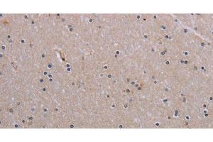 Immunohistochemistry of paraffin-embedded Human brain tissue using NAIP Polyclonal Antibody at dilution 1:30 (NAIP 抗体)