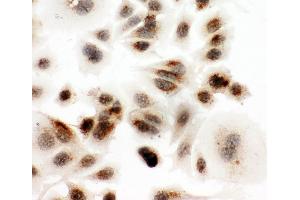 Immunohistochemistry (IHC) image for anti-DEAD Box Protein 4 (DDX4) (AA 253-272), (Middle Region) antibody (ABIN3044032)