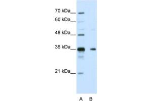 Western Blotting (WB) image for anti-Nanos Homolog 1 (NANOS1) antibody (ABIN2462365) (Nanos Homolog 1 抗体)