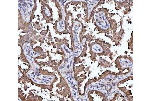 IHC analysis of MRPS22 using anti-MRPS22 antibody (ABIN7600613). (MRPS22 抗体  (AA 21-329))