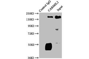 Immunoprecipitating CARMIL2 in Jurkat whole cell lysate Lane 1: Rabbit control IgG instead of ABIN7146660 in Jurkat whole cell lysate. (RLTPR 抗体  (AA 1136-1290))