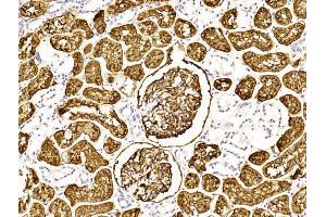 Immunohistochemical analysis of paraffin-embedded Human kidney section using Pink1 (ABIN6243087 and ABIN6577253). (MME 抗体  (AA 472-505))