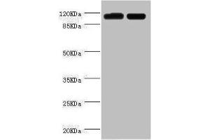 Western blot All lanes: PITRM1 antibody at 2 μg/mL Lane 1: A549 whole cell lysate Lane 2: Mouse kidney tissue Secondary Goat polyclonal to rabbit IgG at 1/10000 dilution Predicted band size: 118, 107 kDa Observed band size: 118 kDa