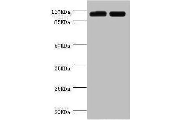 PITRM1 Antikörper  (AA 758-1037)