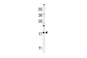 VP4 Antibody (Center) (ABIN652042 and ABIN2840516) western blot analysis in mouse liver tissue lysates (35 μg/lane). (VAMP4 抗体  (AA 16-45))