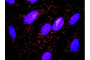 Proximity Ligation Analysis of protein-protein interactions between MYLK and CTTN. (MYLK 抗体  (AA 1-992))