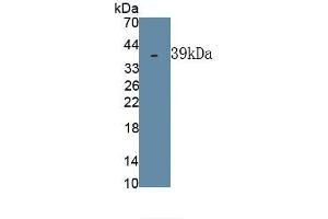 Detection of Recombinant DSPP, Human using Polyclonal Antibody to Dentin Sialophosphoprotein (DSPP) (DSPP 抗体  (AA 82-326))