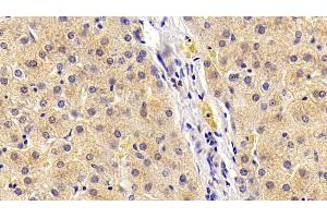 Detection of FGF21 in Porcine Liver Tissue using Polyclonal Antibody to Fibroblast Growth Factor 21 (FGF21) (FGF21 抗体  (AA 28-208))
