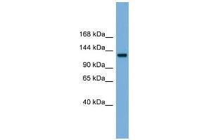 WB Suggested Anti-RASGRF1 Antibody Titration: 0. (RASGRF1 抗体  (Middle Region))
