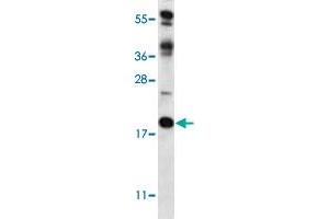 Western blot analysis of mouse heart tissue lysate (35 ug/lane) with RCAN2 polyclonal antibody . (RCAN2 抗体  (N-Term))