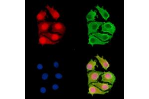 ABIN7096035 and ABIN7100097 staining Hela cells by IF/ICC.