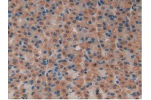 IHC-P analysis of Rat Stomach Tissue, with DAB staining. (SFTPB 抗体  (AA 111-329))