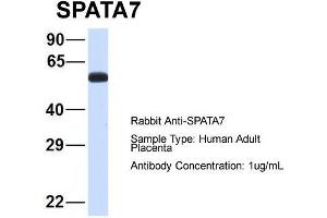 Host: Rabbit  Target Name: SPATA7  Sample Tissue: Human Adult Placenta  Antibody Dilution: 1. (SPATA7 抗体  (Middle Region))