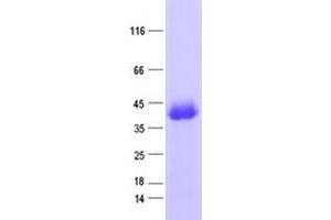 Western Blotting (WB) image for Zinc Finger Protein 187 (ZNF187) protein (His tag) (ABIN2735940)