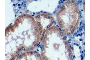Detection of NFKB3 in Human Kidney Tissue using Polyclonal Antibody to Transcription Factor P65 (NFKB3)