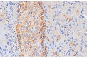 Immunohistochemistry of paraffin-embedded Rat pancreas using DLL1 Polyclonal Antibody at dilution of 1:100 (40x lens). (DLL1 抗体)