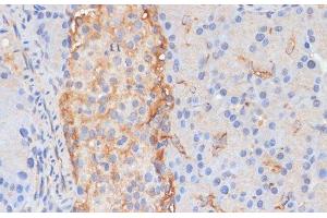 Immunohistochemistry of paraffin-embedded Rat pancreas using DLL1 Polyclonal Antibody at dilution of 1:100 (40x lens). (DLL1 抗体)