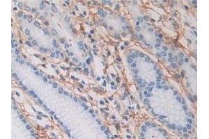 Immunohistochemistry (IHC) image for anti-Periostin (POSTN) (AA 97-230) antibody (ABIN7436453)
