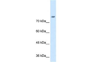 WB Suggested Anti-NRCAM Antibody Titration:  0. (NrCAM 抗体  (N-Term))