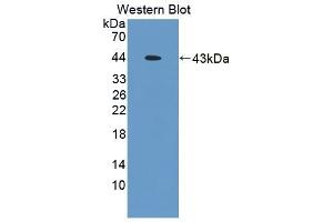 Detection of Recombinant TMOD3, Mouse using Polyclonal Antibody to Tropomodulin 3 (TMOD3) (TMOD3 抗体  (AA 1-352))