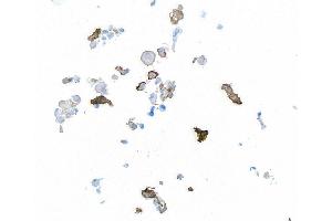 Immunocytochemistry (ICC) image for anti-Actin, alpha 2, Smooth Muscle, Aorta (ACTA2) (AA 1-50) antibody (ABIN7449438)