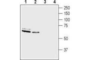 Western blot analysis of rat brain membranes (lanes 1 and 3) and mouse brain membranes (lanes 2 and 4): - 1,2. (ASIC3 抗体  (Intracellular))