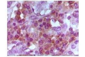 Immunohistochemical analysis of paraffin-embedded human lymphocyto tissue, showing cytoplasmic and nuclear localization using Foxp3 mouse mAb with DAB staining. (FOXP3 抗体)
