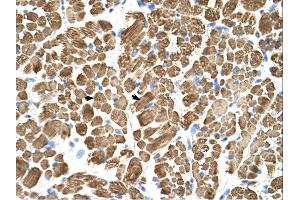 Tropomyosin 2 antibody was used for immunohistochemistry at a concentration of 4-8 ug/ml. (TPM2 抗体)