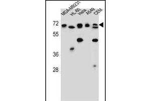 ASMTL Antibody (Center) (ABIN657160 and ABIN2846294) western blot analysis in MDA-M,HL-60,Hela,A549,CEM cell line lysates (35 μg/lane). (ASMTL 抗体  (AA 231-259))