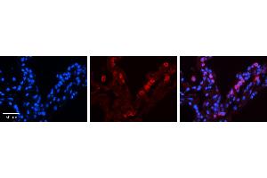 Immunohistochemistry (IHC) image for anti-Signal Transducer and Activator of Transcription 6, Interleukin-4 Induced (STAT6) (C-Term) antibody (ABIN2780481) (STAT6 抗体  (C-Term))