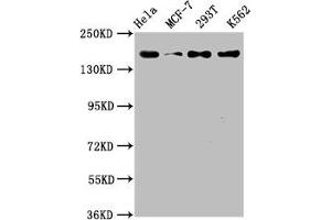 Western Blot Positive WB detected in: Hela whole cell lysate, MCF-7 whole cell lysate, 293T whole cell lysate, K562 whole cell lysate All lanes: HDAC9 antibody at 1. (Recombinant HDAC9 抗体)