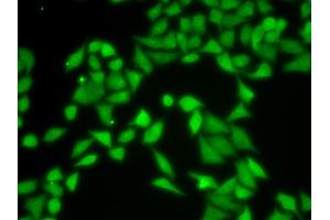 Immunofluorescence analysis of MCF-7 cells using R antibody (ABIN6131708, ABIN6141226, ABIN6141228 and ABIN6217372). (GNB2L1 抗体  (AA 30-290))