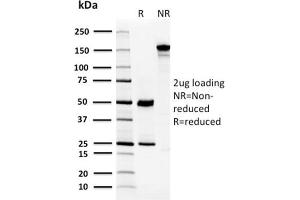 SDS-PAGE Analysis Purified CA8 Mouse Monoclonal Antibody (CPTC-CA8-2).