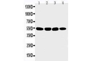 Anti-Matrilin 3 antibody, Western blotting Lane 1: 293T Cell Lysate Lane 2: COLO320 Cell Lysate Lane 3: HELA Cell Lysate Lane 4: A549 Cell Lysate (Matrilin 3 抗体  (C-Term))