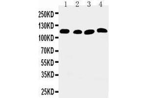 Anti-SERCA2 ATPase antibody, Western blotting Lane 1: Rat Skeletal Muscle Tissue Lysate Lane 2: Rat Kidney Tissue Lysate Lane 3: PANC Cell Lysate Lane 4: SMMC Cell Lysate (ATP2A2 抗体  (Middle Region))